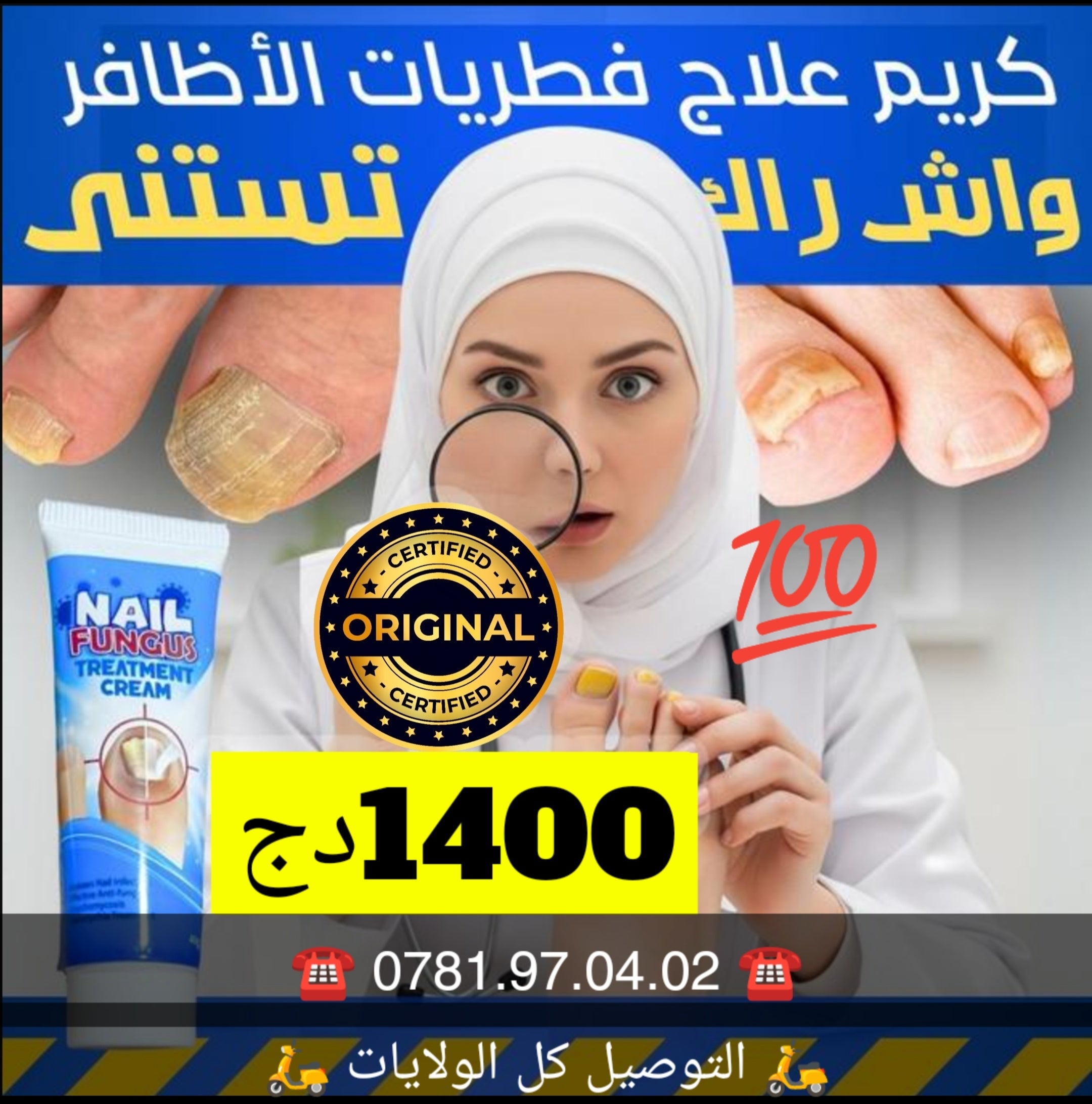 كريم علاج فطريات الأظافر (140ألف)