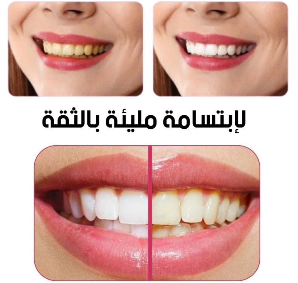 معجون الأسنان مارفيس (145ألف)