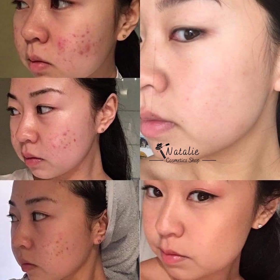 AVÈNE CICALFATE+ 40ML (PROMO) 2000da